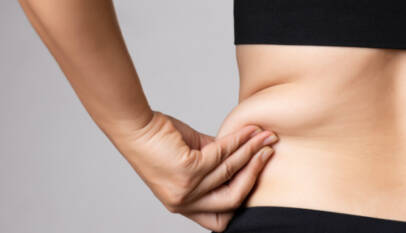 Liposuction in Dubai