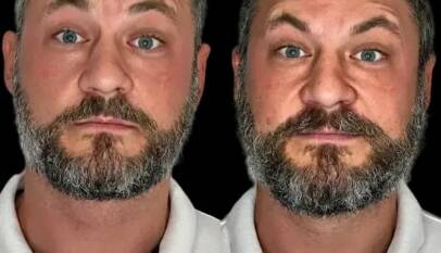 Best Aesthetic Clinic in dubai