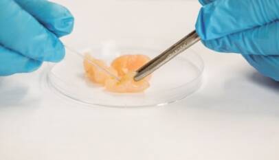 egg freezing procedure