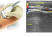 Diagnosis and Treatment with Peripheral Ultrasound